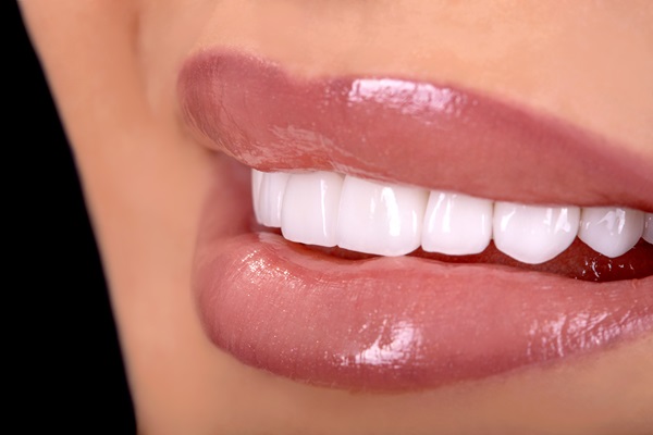 How Long Does Professional In Office Teeth Whitening Take?